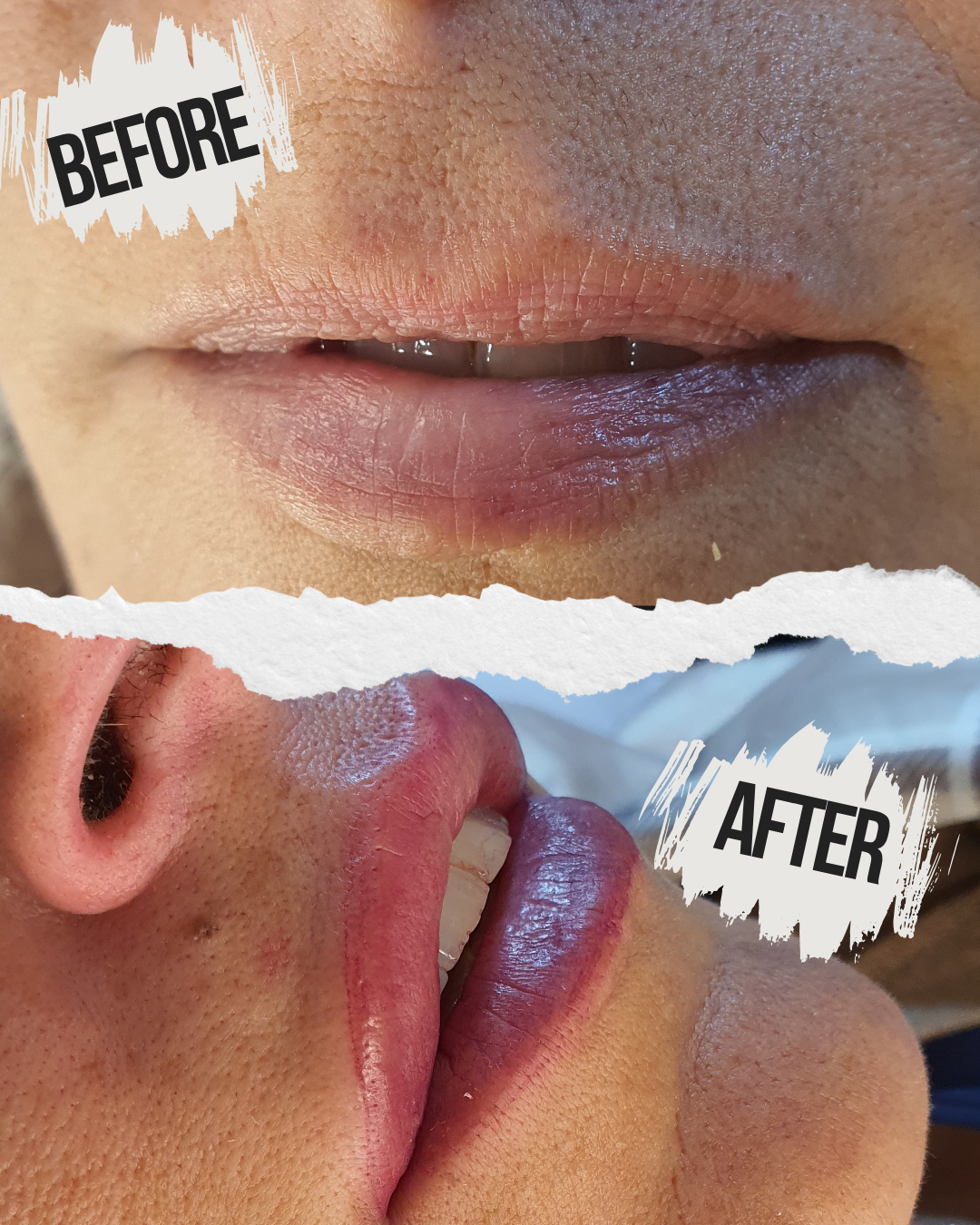 לפני ואחרי - הסלוניו של גילי נהריה