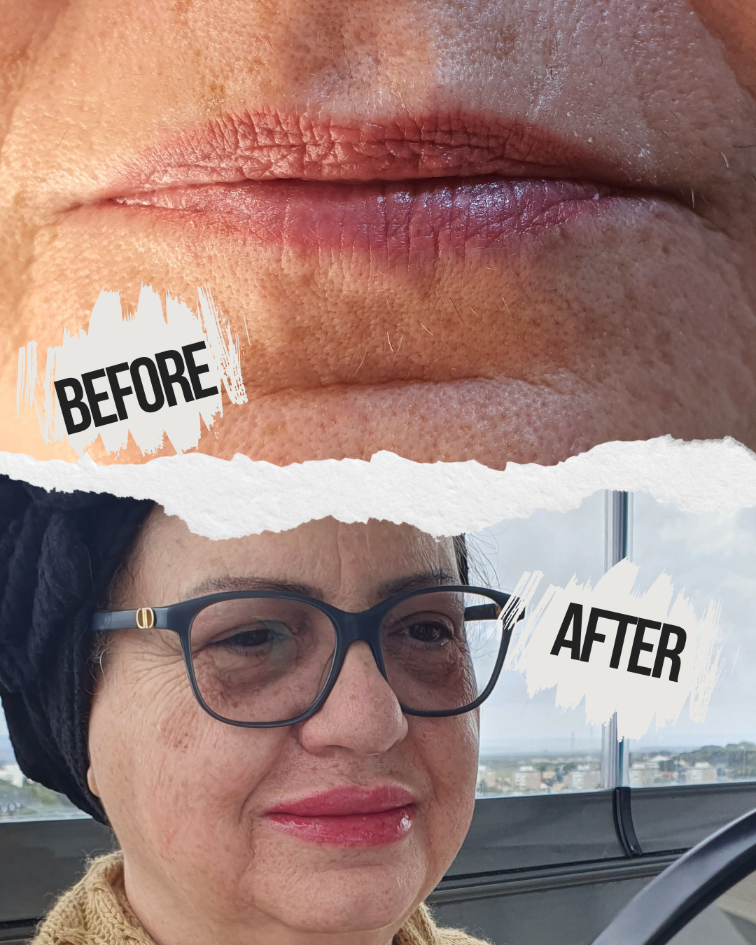 לפני ואחרי - הסלוניו של גילי נהריה